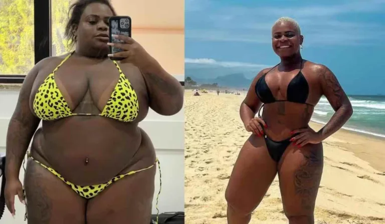 Quantos quilos Jojo Todynho perdeu após a bariátrica