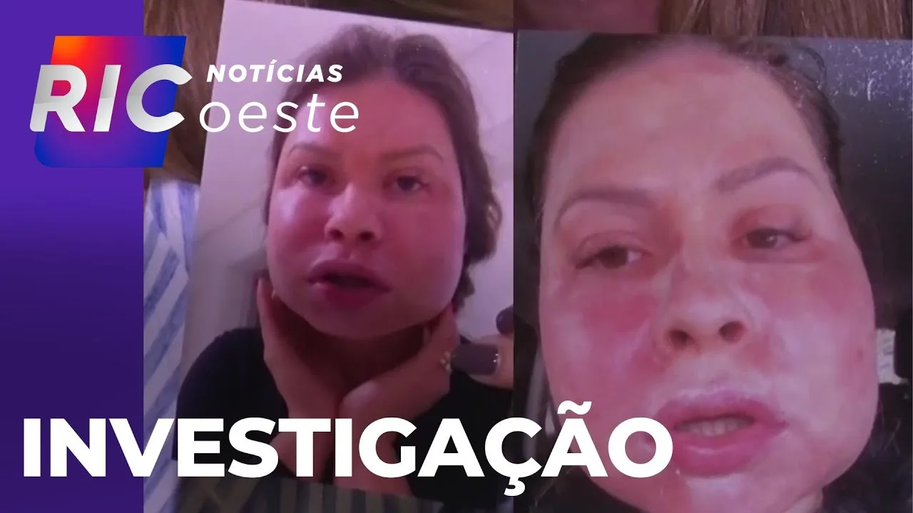 Polícia Civil investiga casal, suspeito de realizar procedimento que deformou paciente