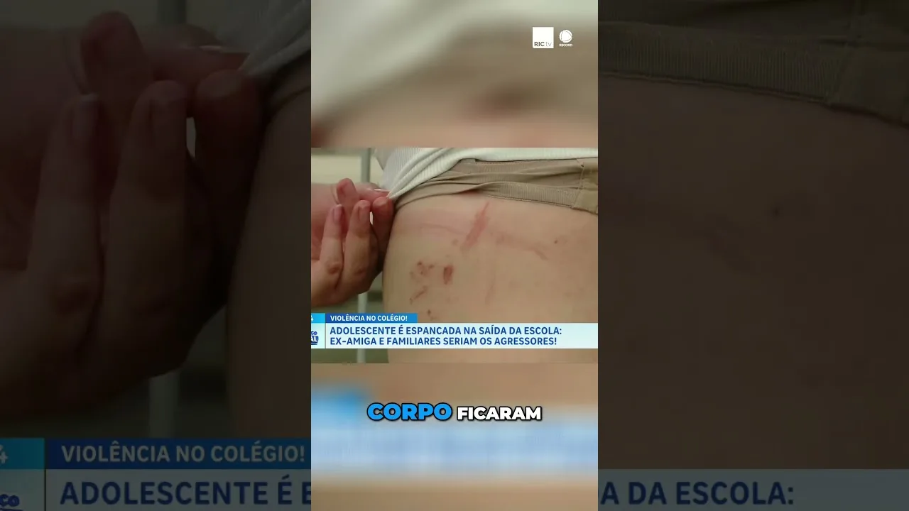 Adolescente é espancada na saída da escola: ex-amiga e familiares seriam os agressores