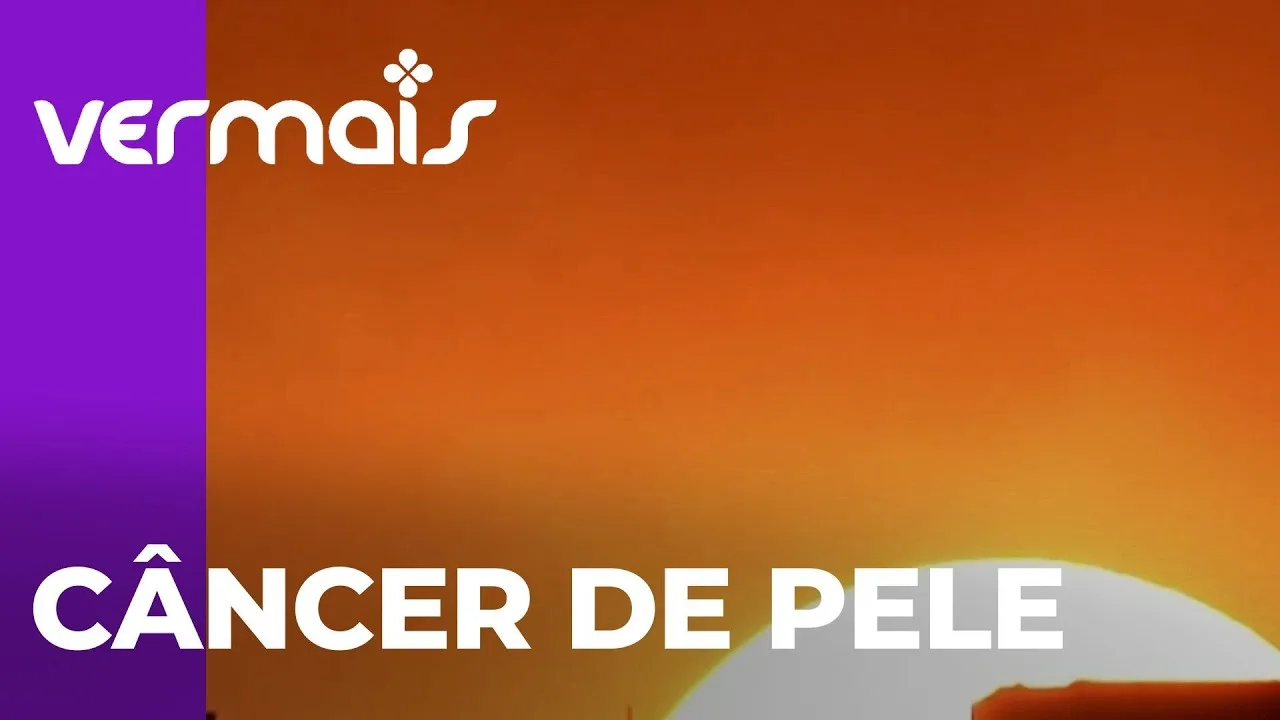 Câncer de pele: sintomas, prevenção e tratamentos essenciais
