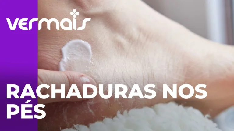 Como cuidar e ter saúde nos pés