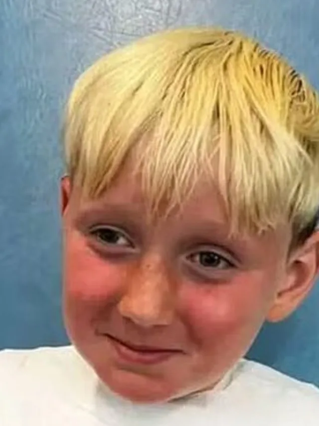 Criança sofre queimaduras graves em todo o corpo após usar protetor solar vencido