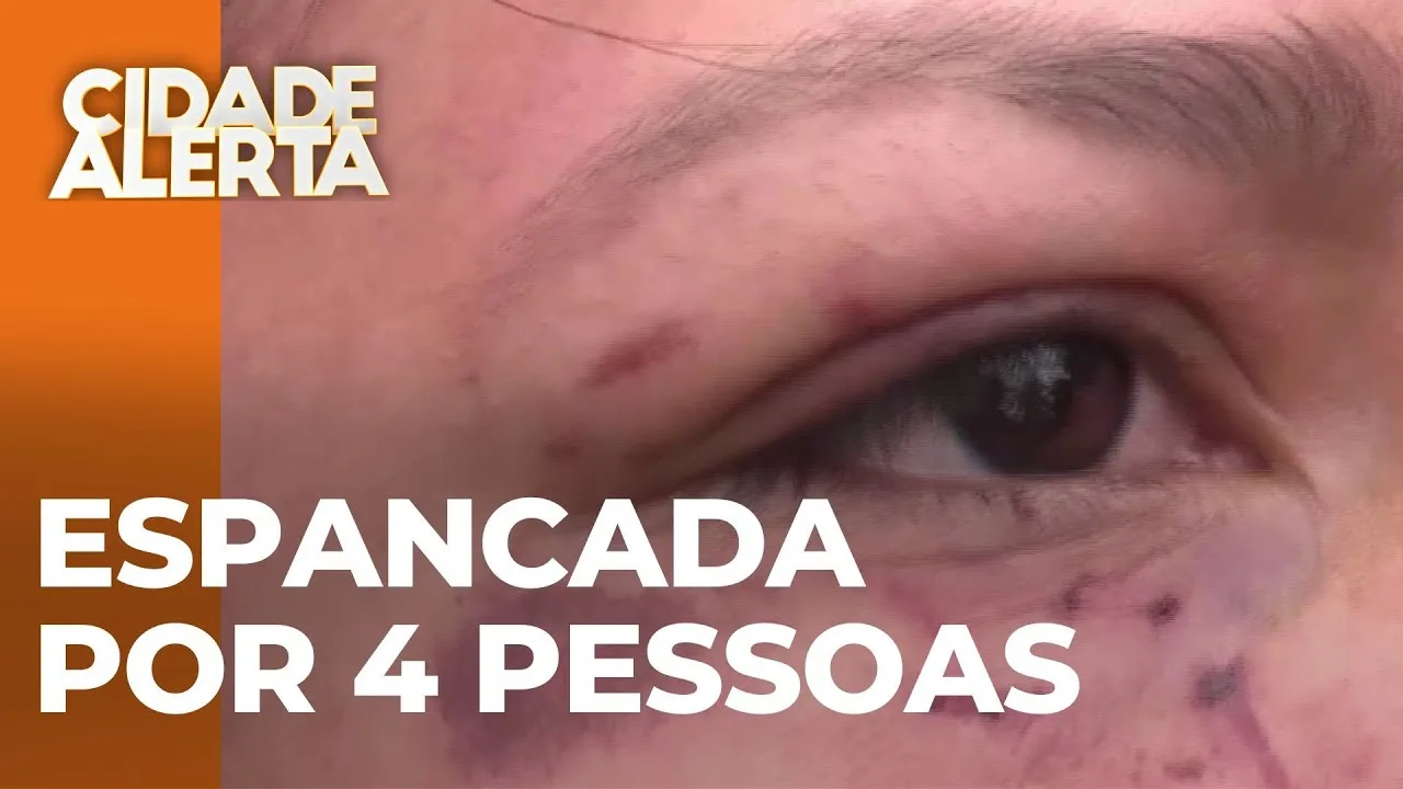 Caso de agressão: Mulher é espancada pelo ex e três amigas com golpes brutais