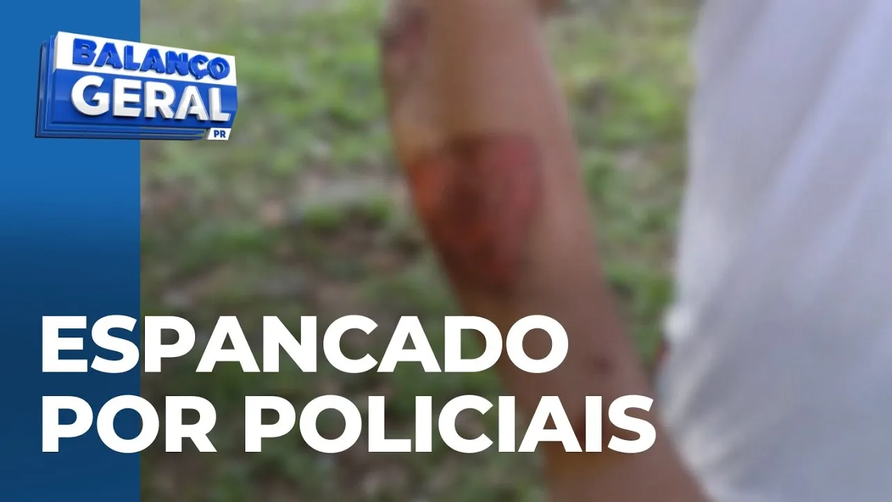 Jovem diz que foi espancado por policiais; Câmera flagra agressões e viatura o atropelando