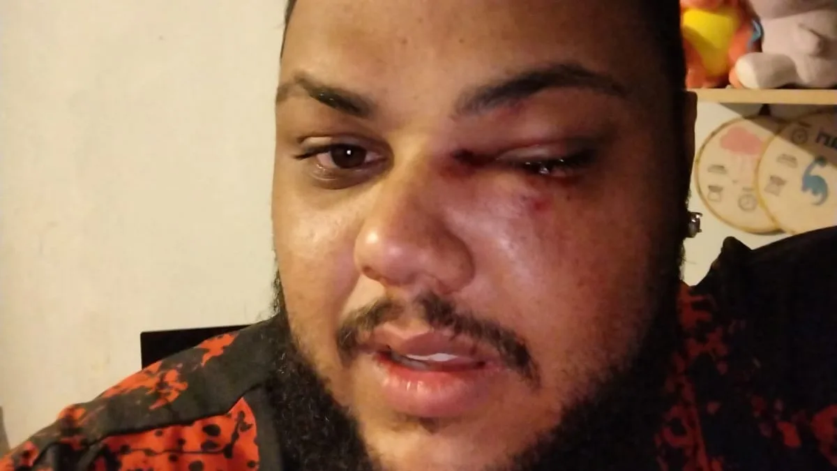 torcedor do Athletico que mostrou a bunda em jogo