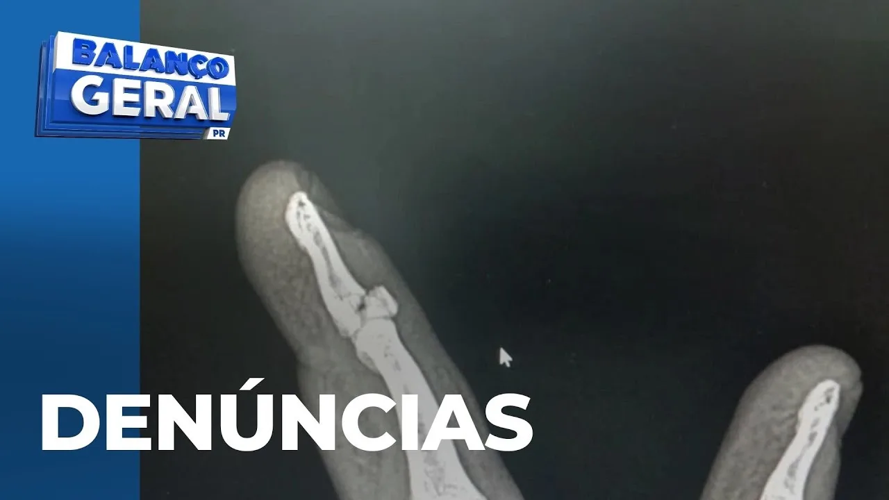 Dono de revenda de carros é suspeito de aplicar golpes e fazer ameaças; mecânico teve dedo quebrado