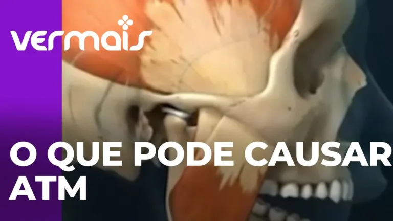 Quais são as causas ,sintomas ,diagnósticos e tratamento