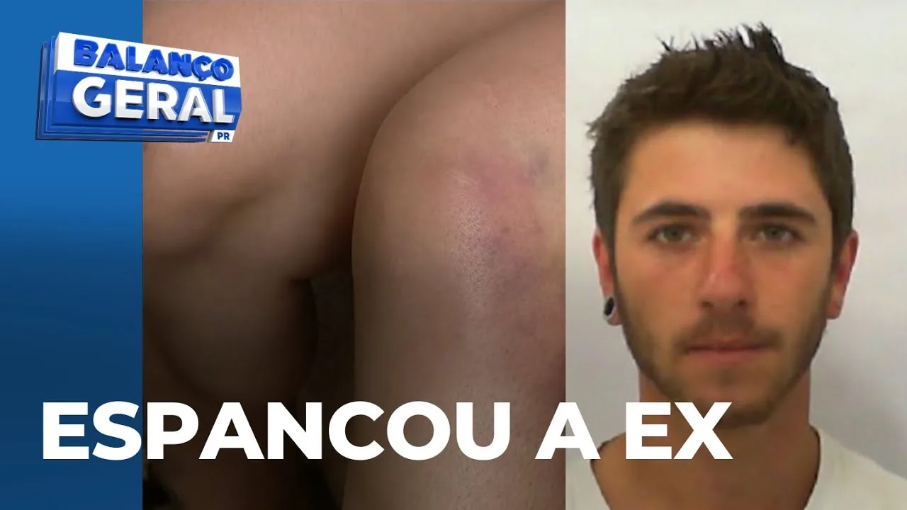 Mulher espancada pelo ex, que não aceitava o fim da relação, abre o jogo sobre a noite de violência