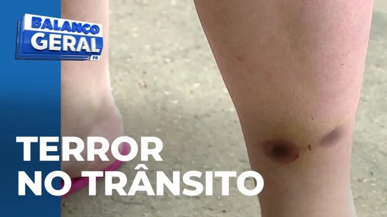 Violência no trânsito: mulher, com bebê de colo, é baleada na perna por conta de uma buzinada