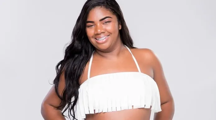 Raquel Brito passa por procedimento estético e vira piada (Imagem: Divulgação / RECORD TV)