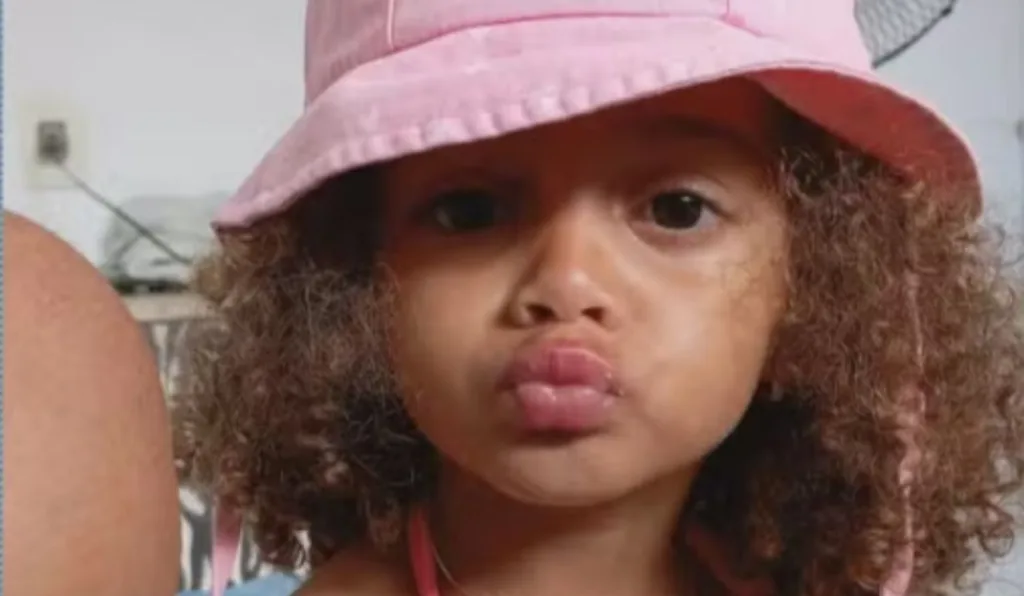 perola hadassa, criança que sofreu traumatismo craniano após ser empurrada