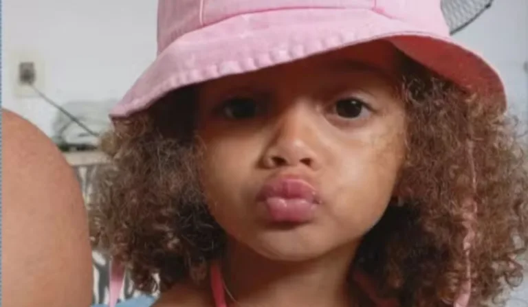 perola hadassa, criança que sofreu traumatismo craniano após ser empurrada