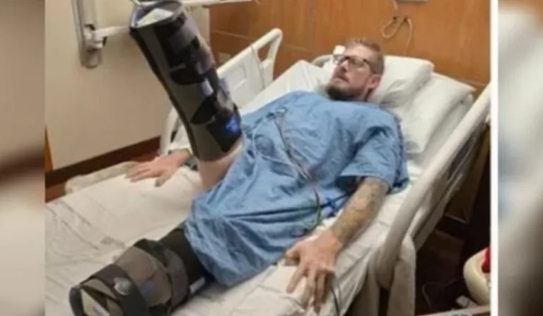 max logo após ter duas pernas amputadas