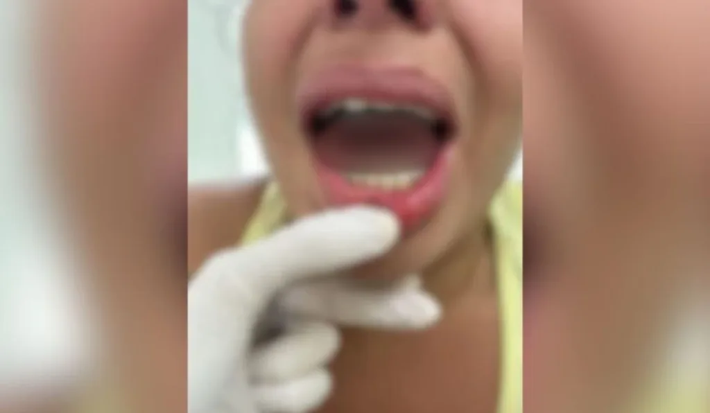 mulher com língua arrancada