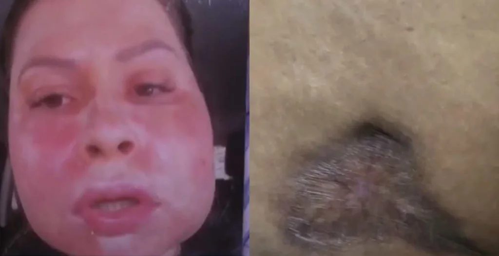 Casal é denunciado por deformar rosto de paciente em procedimento estético no PR
