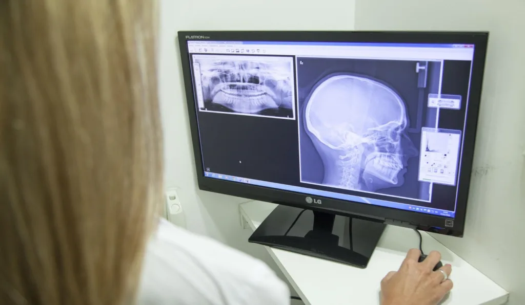 médica observando exame de imagem