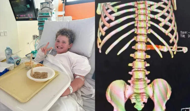 criança com faca cravada nas costas após cair na lava-louça