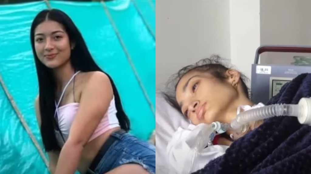 À esquerda, Érika antes da agressão. À direita, Érika na cama do hospital.