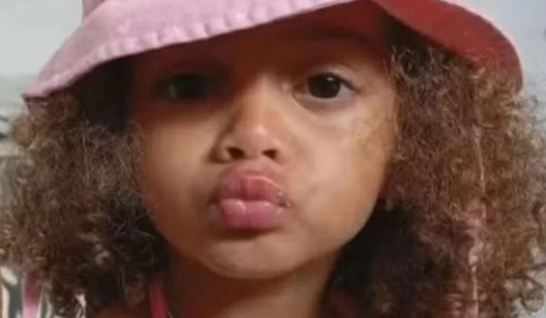 criança que sofreu traumatismo craniano