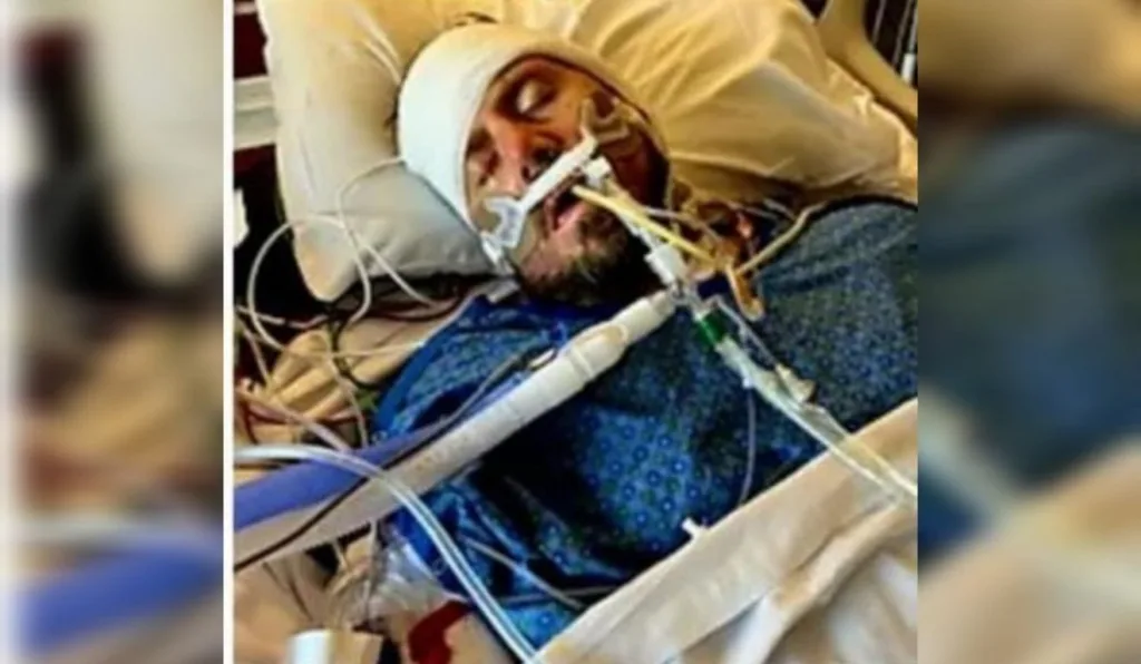 homem em coma antes de ter duas pernas amputadas