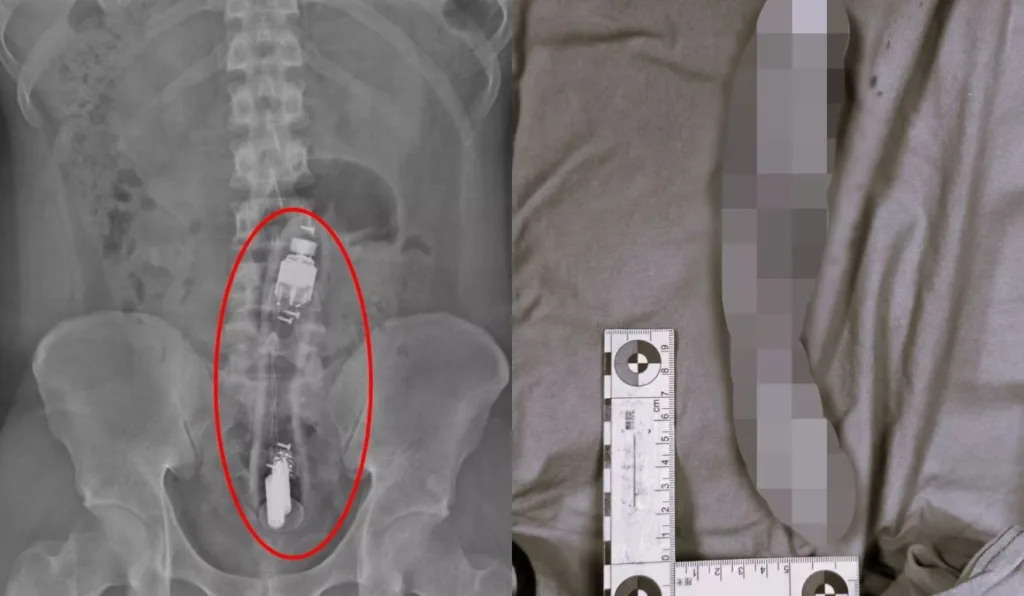 vibrador dentro de ânus