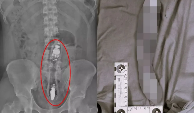 vibrador dentro de ânus