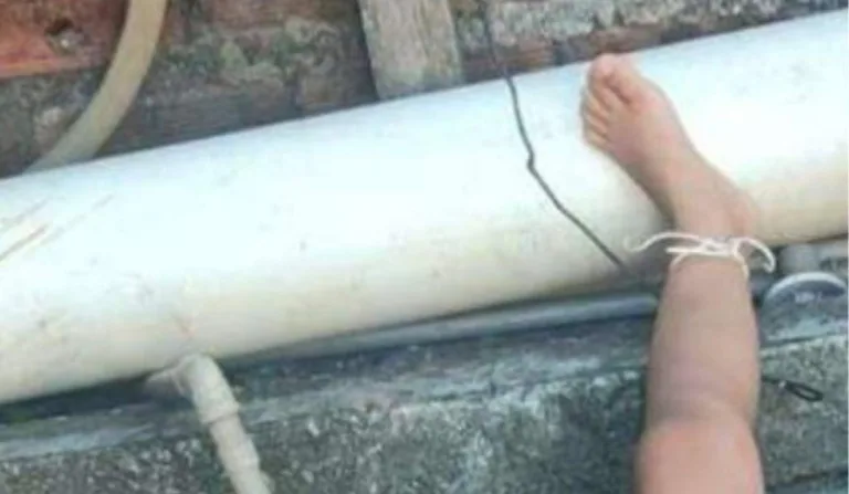 Perna de criança amarrada no quintal