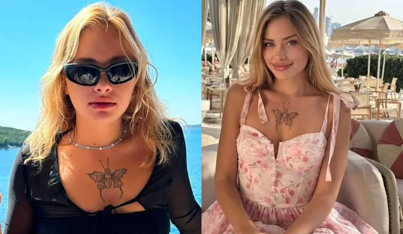 Maria Kovalchuk, modelo em estado grave