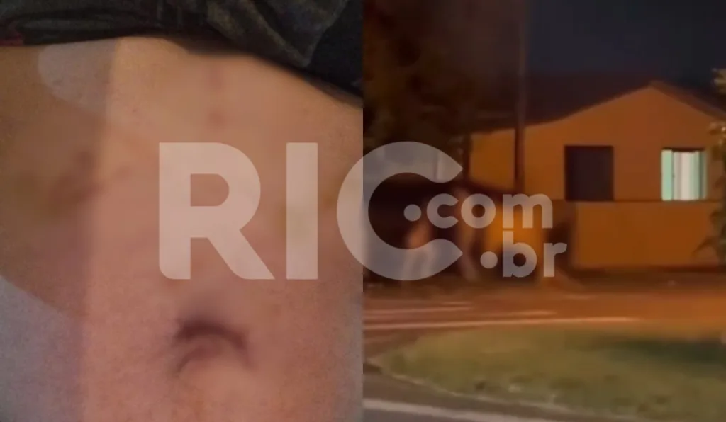 barriga machucada e briga em rua