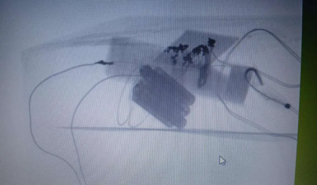 Imagens de scanner revelam conteúdo de pacote explosivo que interditou terminal