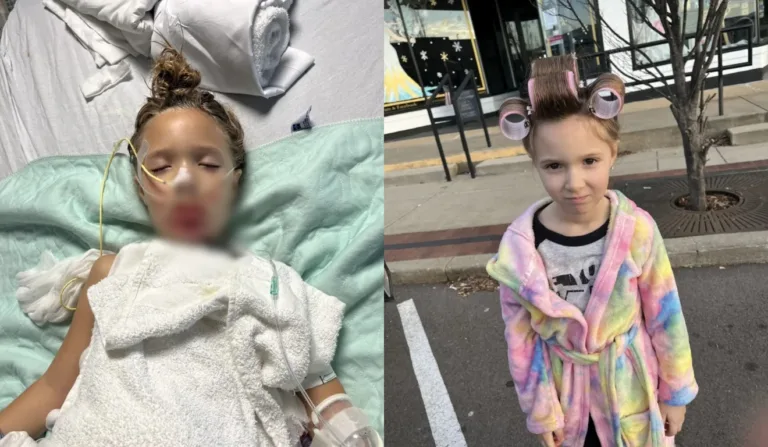 Scarllet ficou com o rosto queimado durante desafio do TikTok