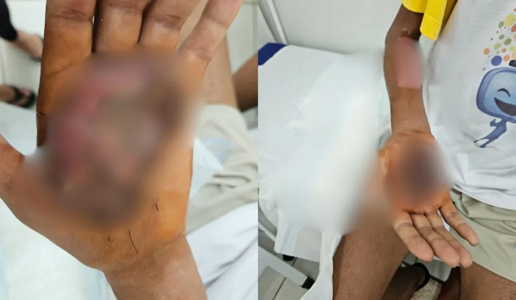 mãos de adolescente torturada por mãe de santo