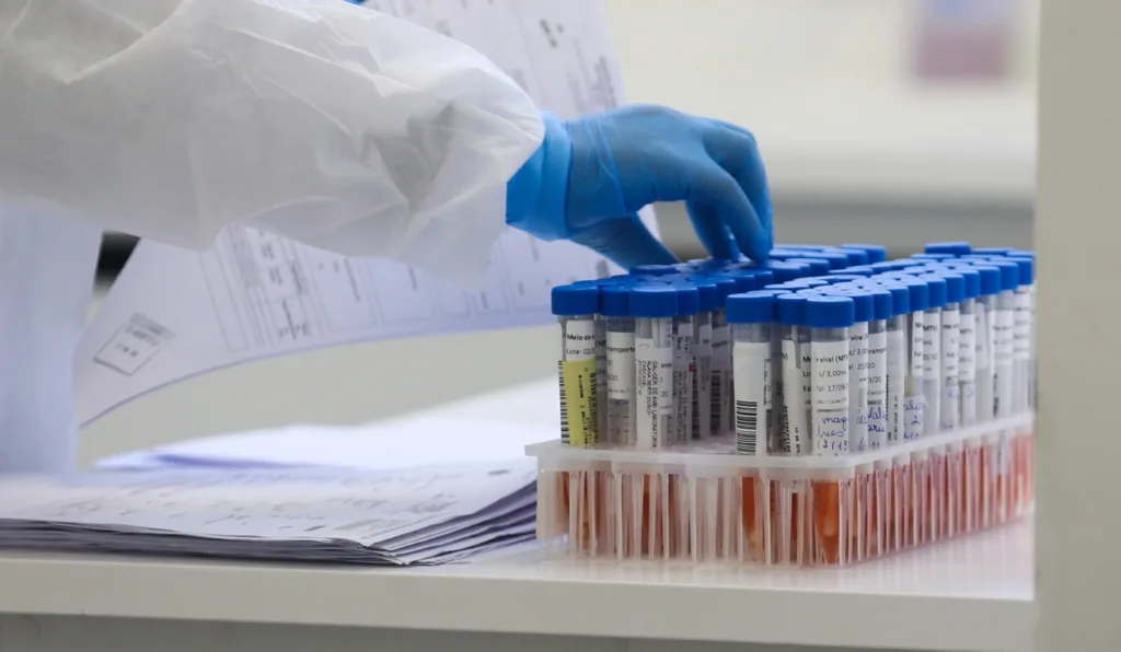 Com 62 óbitos por Covid-19 em 2025, Secretaria da Saúde reforça importância da vacina