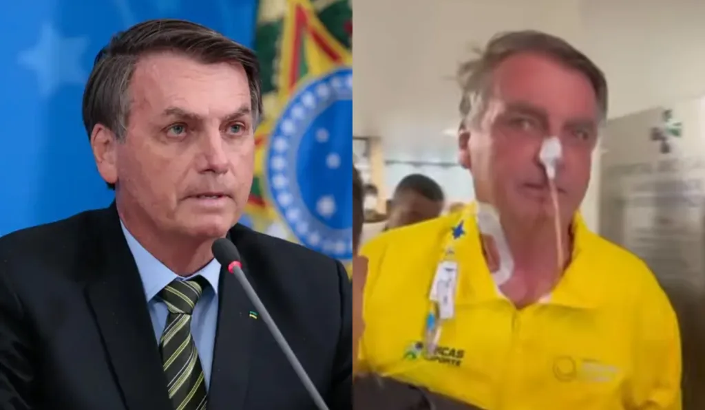 cirurgia laparotomia exploradora bolsonaro 