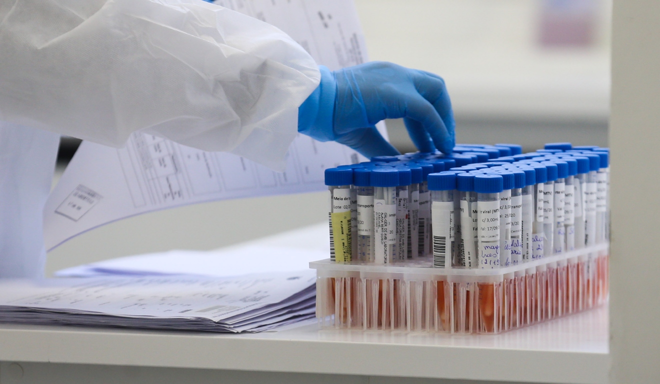 Com 62 óbitos por Covid-19 em 2025, Secretaria da Saúde reforça importância da vacina