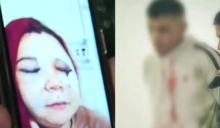 atendente de call center que ficou cega de um olho