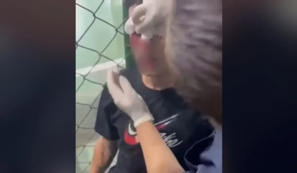 jogador que foi atingido por bomba em vestiário