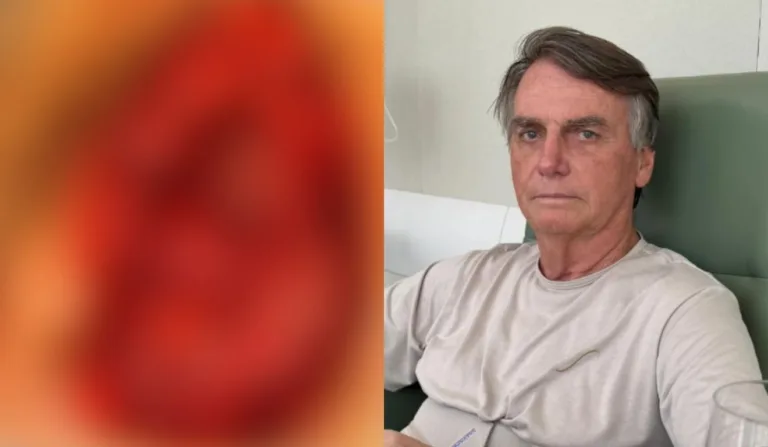 barriga aberta de bolsonaro