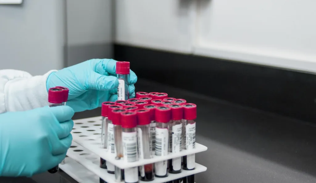tubos de ensaio com exames de sangue