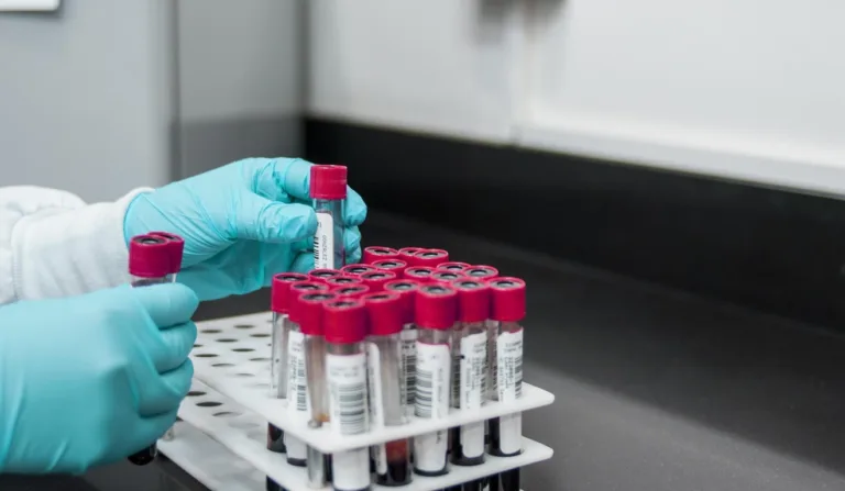 tubos de ensaio com exames de sangue