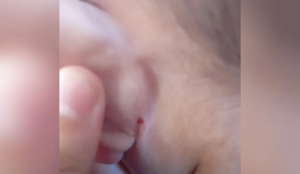 bebê deixado em boca de fumo apresentava ferimentos