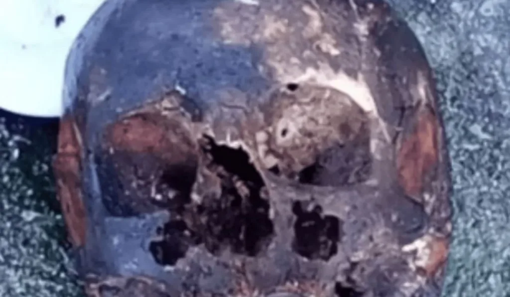 cranio humano encontrado em rodovia