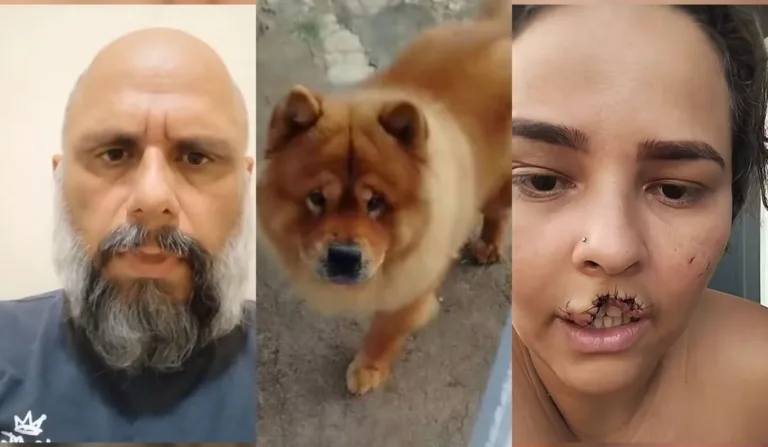 marido que mandou sacrificar cachorro que arrancou lábio de esposa