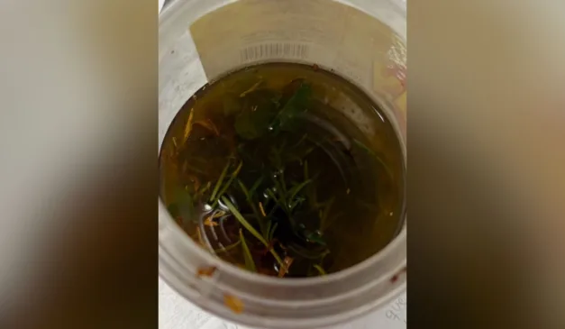 mistura de intoxicou bebê