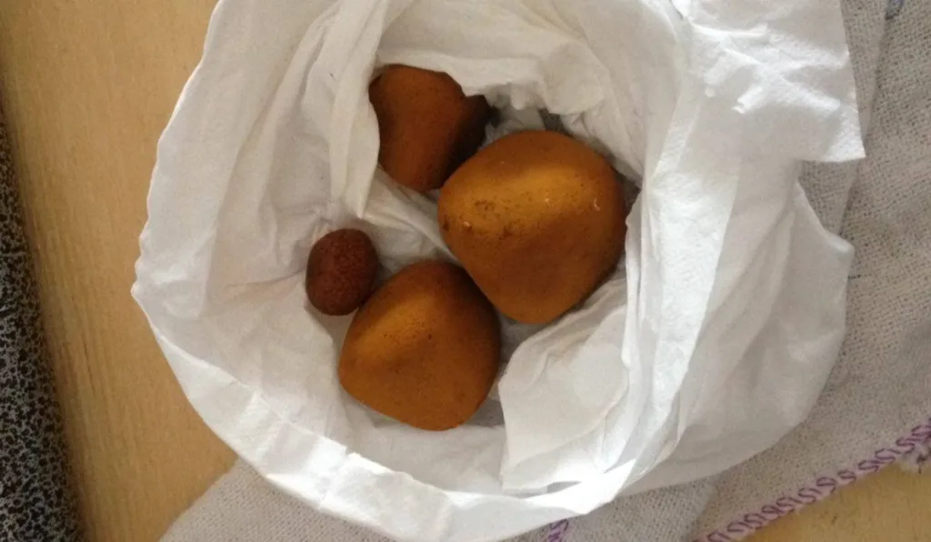 pedras de fel do boi