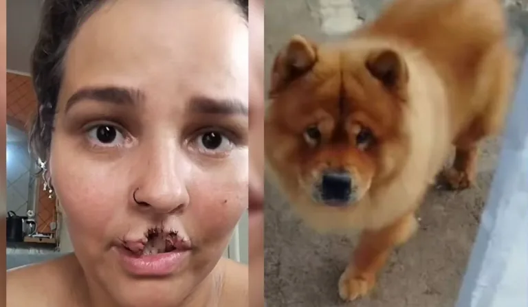 mulher que teve lábio arrancado por cachorro