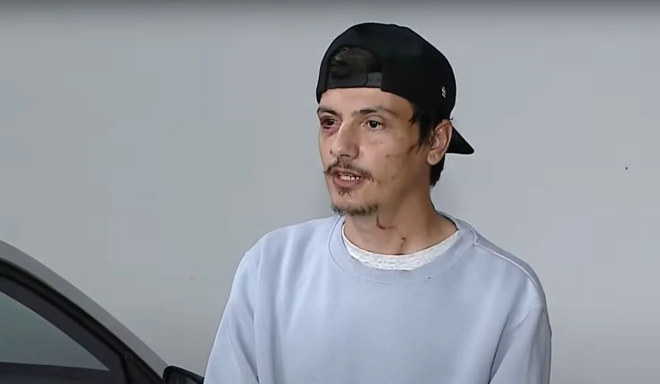 Lucas Tesche, motorista que foi agredido com tesouradas