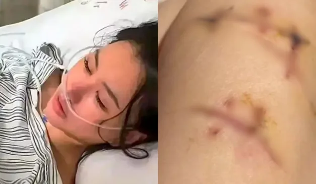 mulher que sobreviveu a 22 facadas por causa do silicone