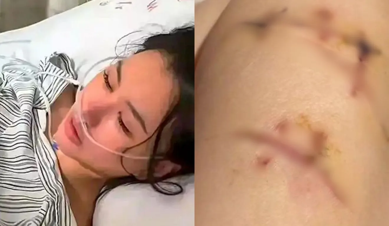 mulher que sobreviveu a 22 facadas por causa do silicone