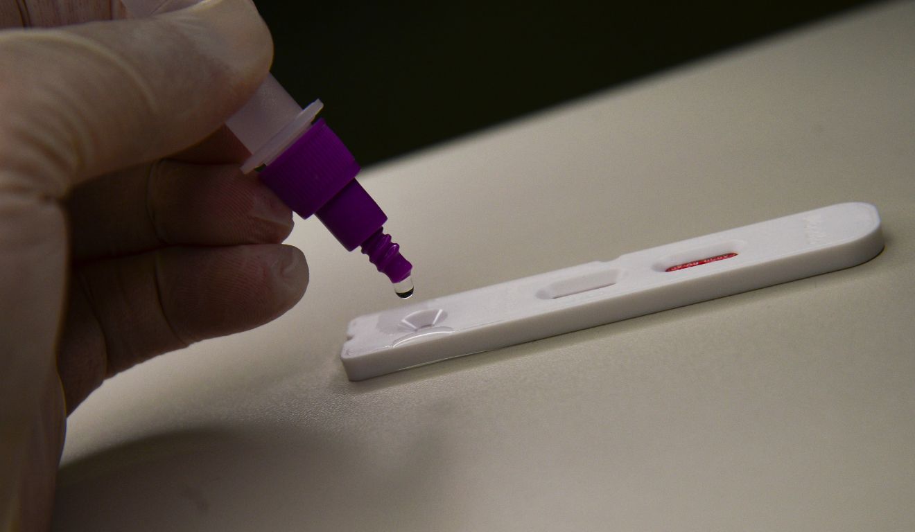 Teste para detecção de casos de Covid-19; Paraná registra mortes pela doença